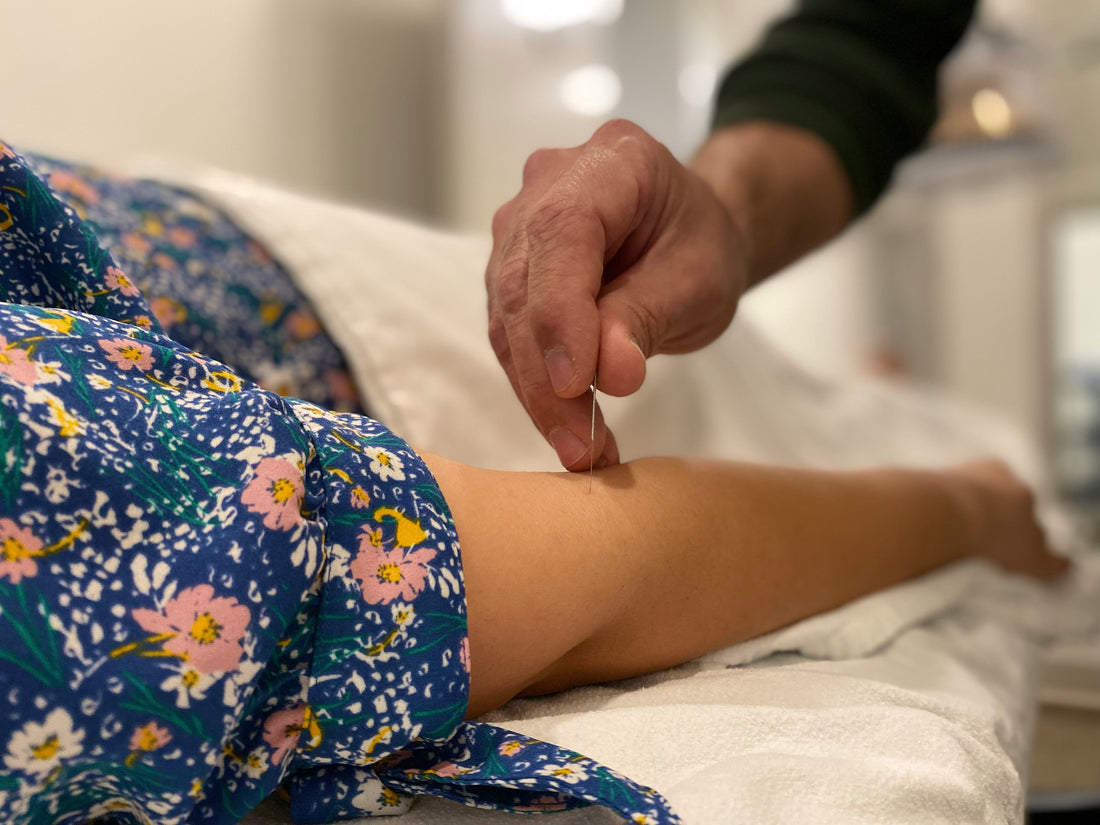How Many Acupuncture Sessions Do You Need?