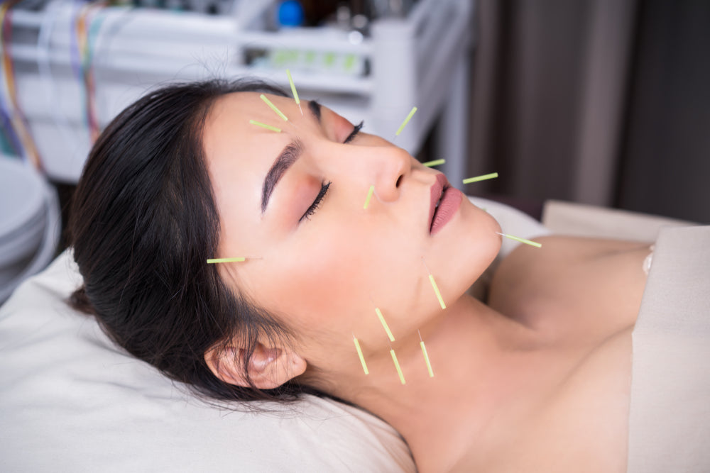 Acupuncture for Insomnia in Richmond Hill: The TCM Approach to Chronic Sleep Problems