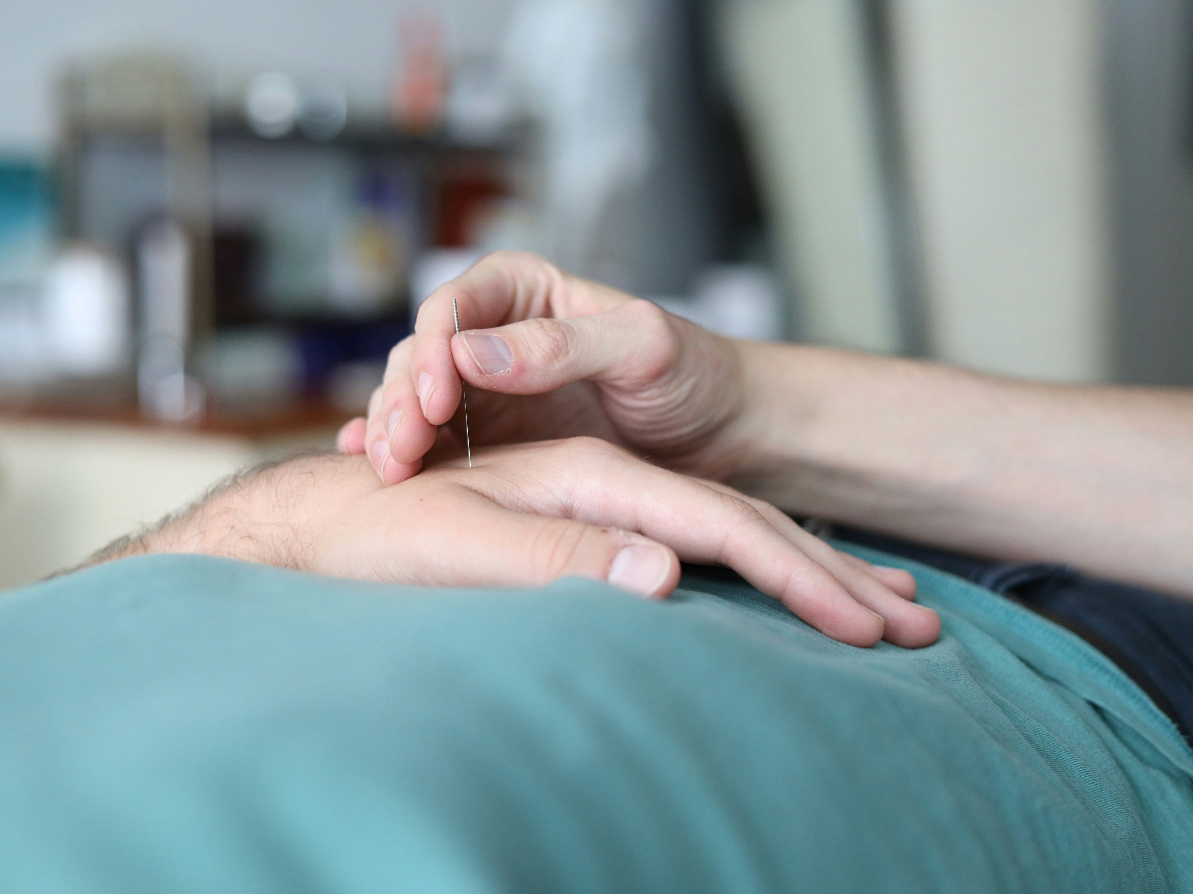 How Often Should You Get Acupuncture