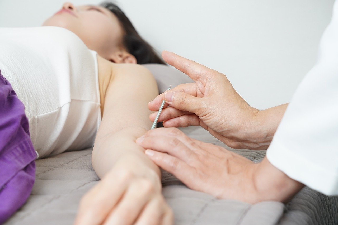 Is Acupuncture Beneficial to People With Chronic Pain
