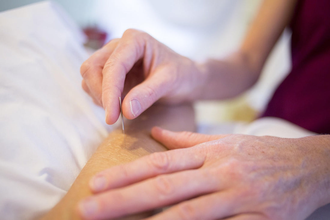 What Does Acupuncture Do for Your Body