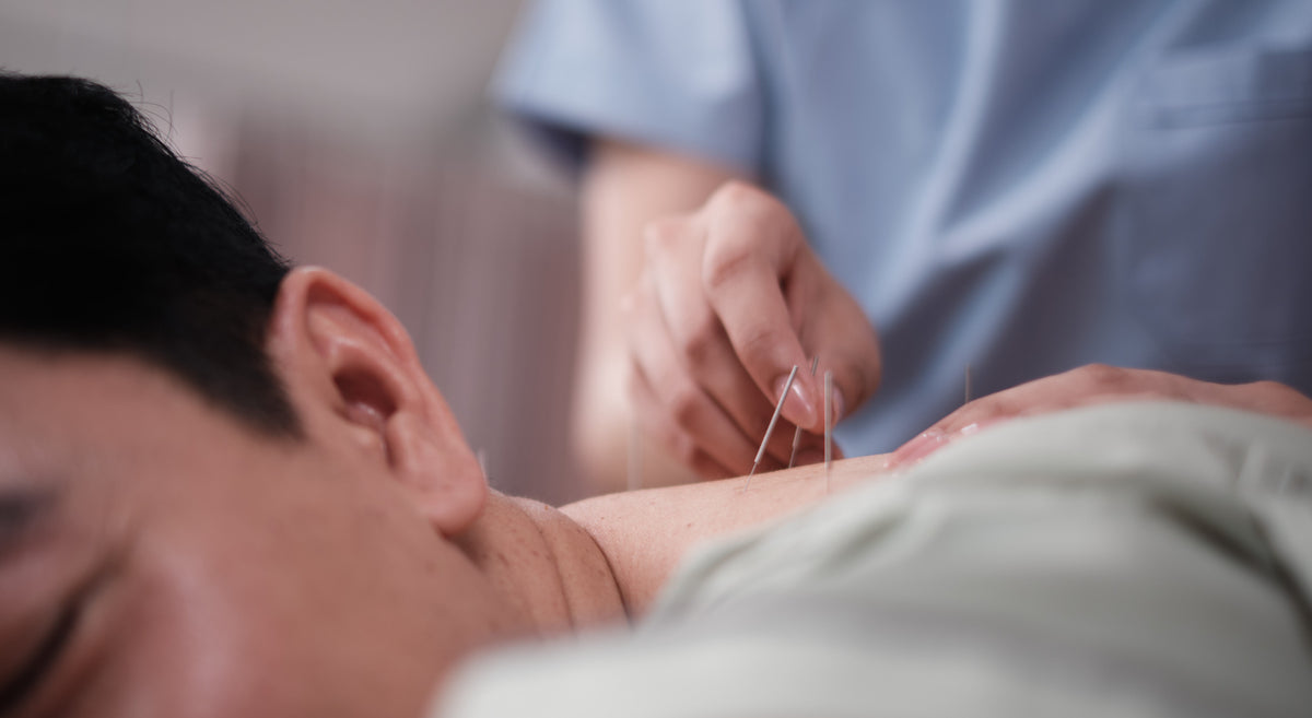How Does Acupuncture Work? A Plain-Language Explanation