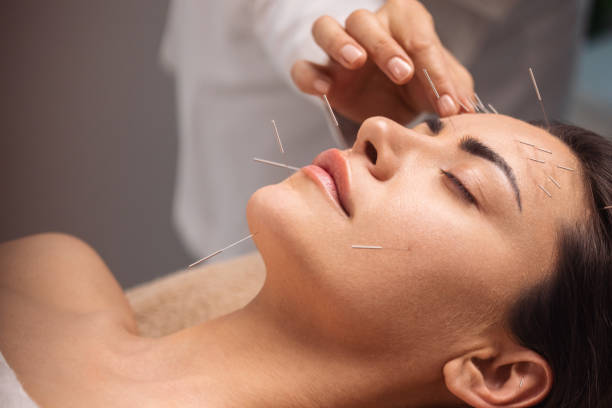 Does Acupuncture Hurt