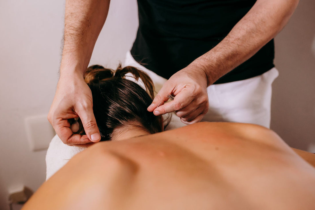 Acupuncture for Neck Pain: What Desk Workers in Richmond Hill Actually Need to Know