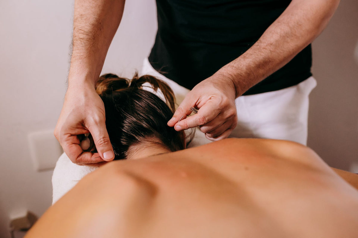 Acupuncture for Neck Pain: What Desk Workers in Richmond Hill Actually Need to Know