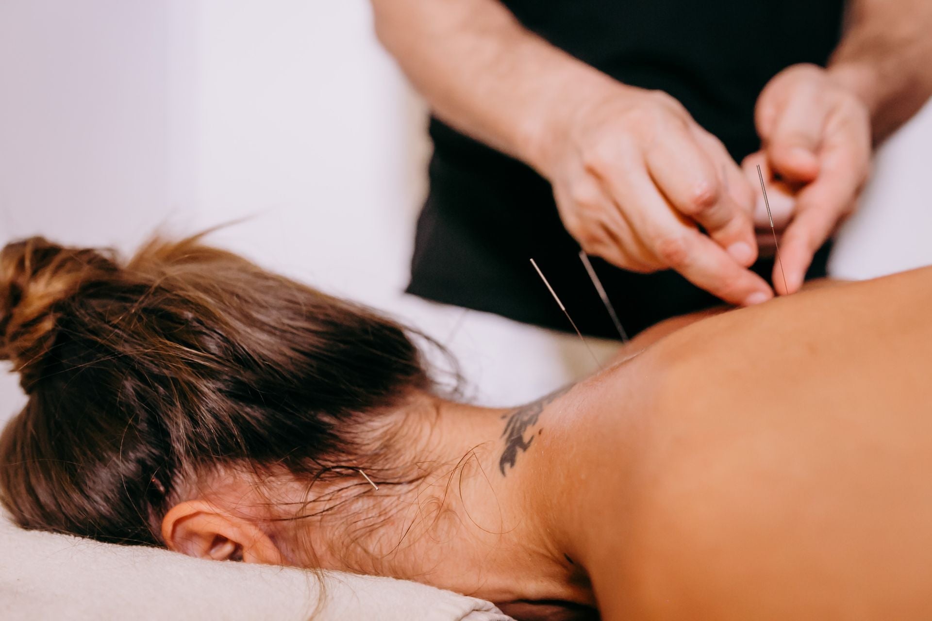 When We Add Moxibustion to a Treatment