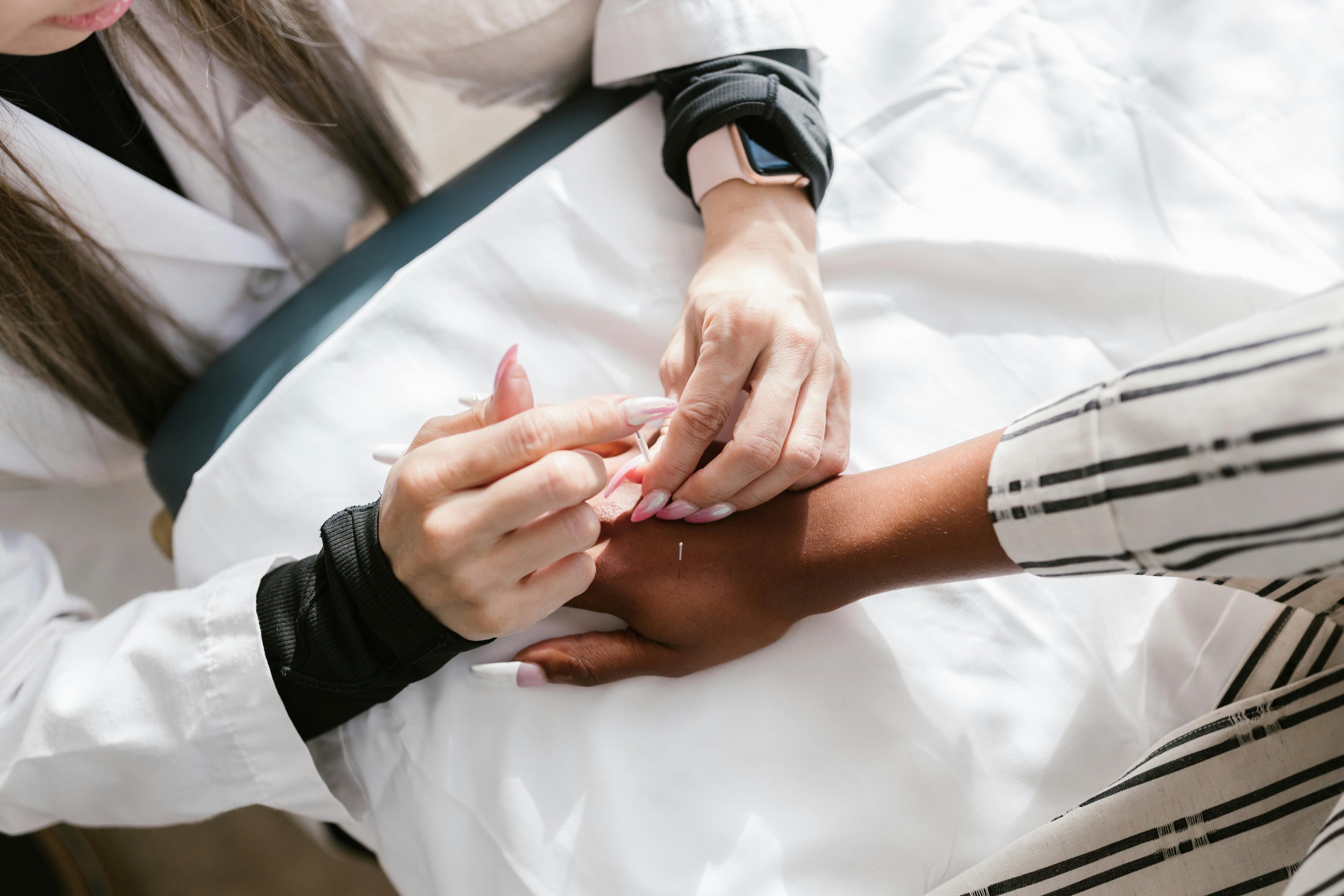 Acupuncture for Anxiety in Richmond Hill: A TCM Approach