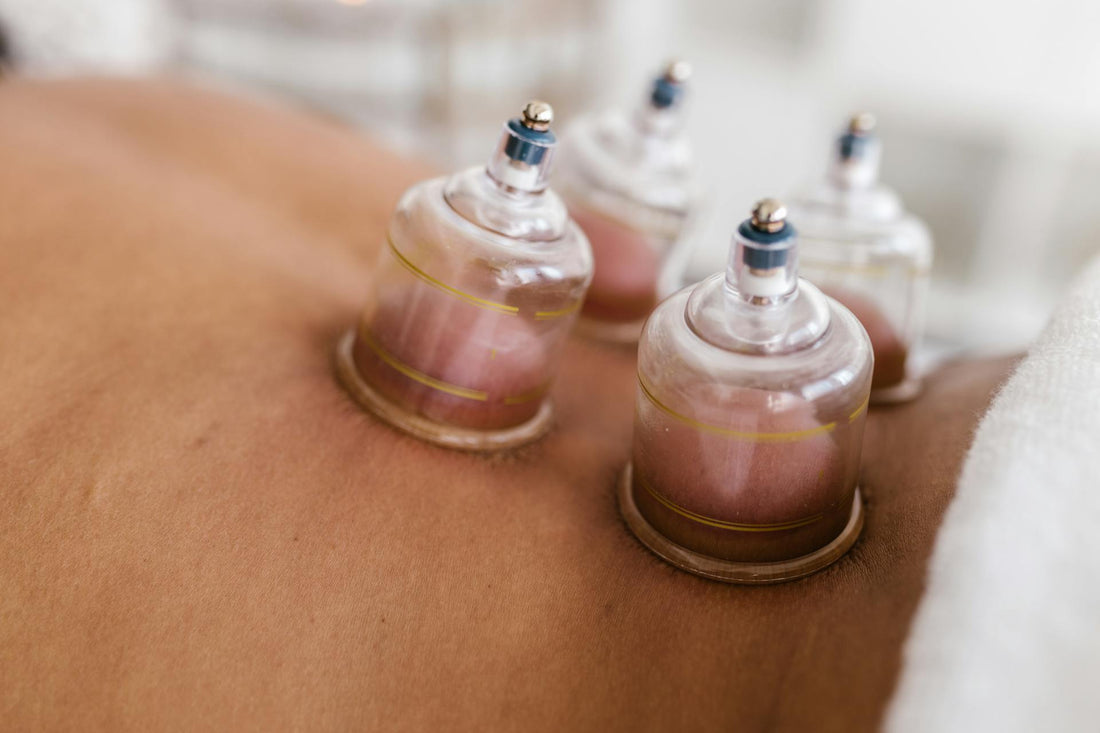 Cupping therapy cups applied to a person’s back during a therapeutic treatment session.